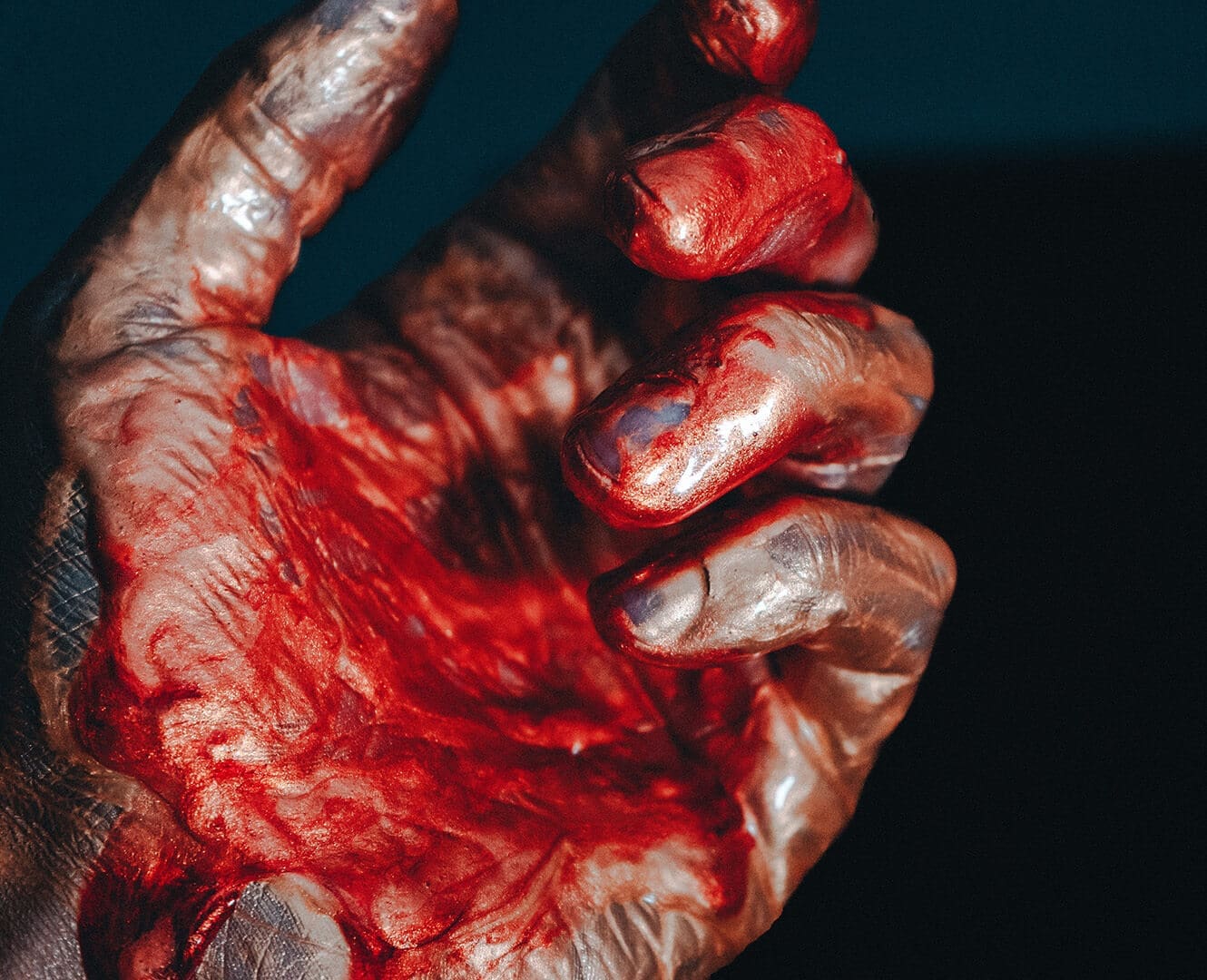 Bloody hand